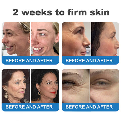 ⏰Ends Today: Buy 1 Get 1 Free! Tiworld®-Polypeptide Collagen Elastic Essence Cream