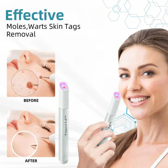 🌎Ends Today: 70% OFF!🔥Tiworld™ All-in-One CO₂ Laser Eraser Pen | USB Rechargeable | Removes Moles, Warts, Skin Flaws & Pigmentation