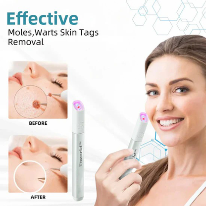 🌎Ends Today: 70% OFF!🔥Tiworld™ All-in-One CO₂ Laser Eraser Pen | USB Rechargeable | Removes Moles, Warts, Skin Flaws & Pigmentation