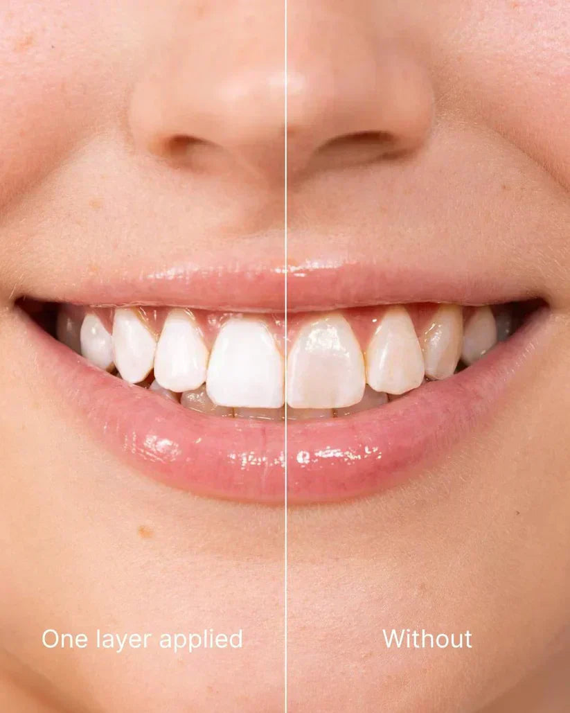 Final 3 Hours! 丨YAGOO™Tooth Polish - Instant Clean Smile