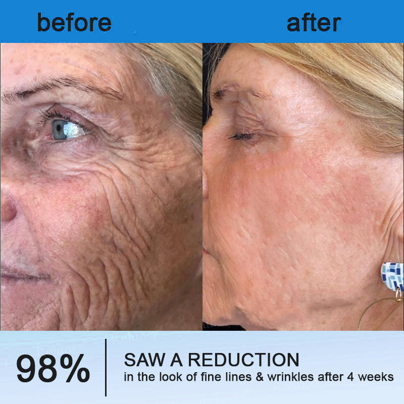 ⏰Ends Today: Buy 1 Get 1 Free! Tiworld®-Polypeptide Collagen Elastic Essence Cream