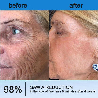 ⏰Ends Today: Buy 1 Get 1 Free! Tiworld®-Polypeptide Collagen Elastic Essence Cream