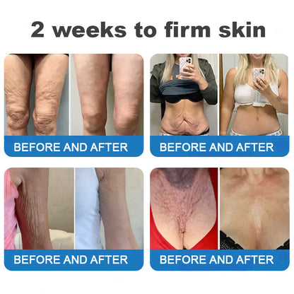 ⏰Ends Today: Buy 1 Get 1 Free! Tiworld®-Polypeptide Collagen Elastic Essence Cream