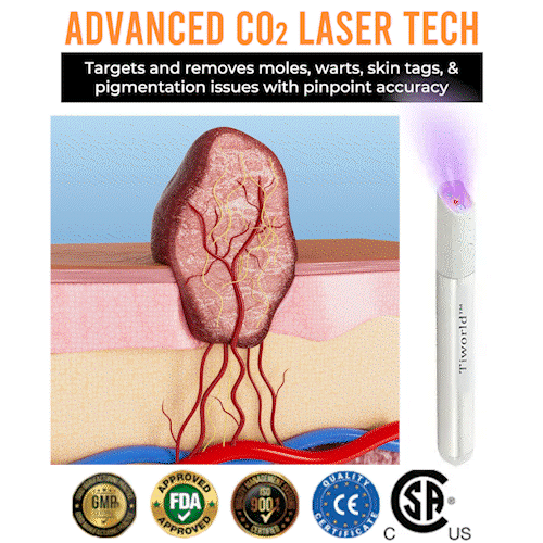 🌎Ends Today: 70% OFF!🔥Tiworld™ All-in-One CO₂ Laser Eraser Pen | USB Rechargeable | Removes Moles, Warts, Skin Flaws & Pigmentation