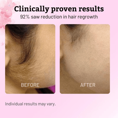 ✨ SEAGRIL Beauty Cyperus Rotundus Oil for Natural Permanent Hair Reduction
