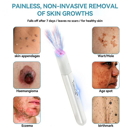 🌎Ends Today: 70% OFF!🔥Tiworld™ All-in-One CO₂ Laser Eraser Pen | USB Rechargeable | Removes Moles, Warts, Skin Flaws & Pigmentation