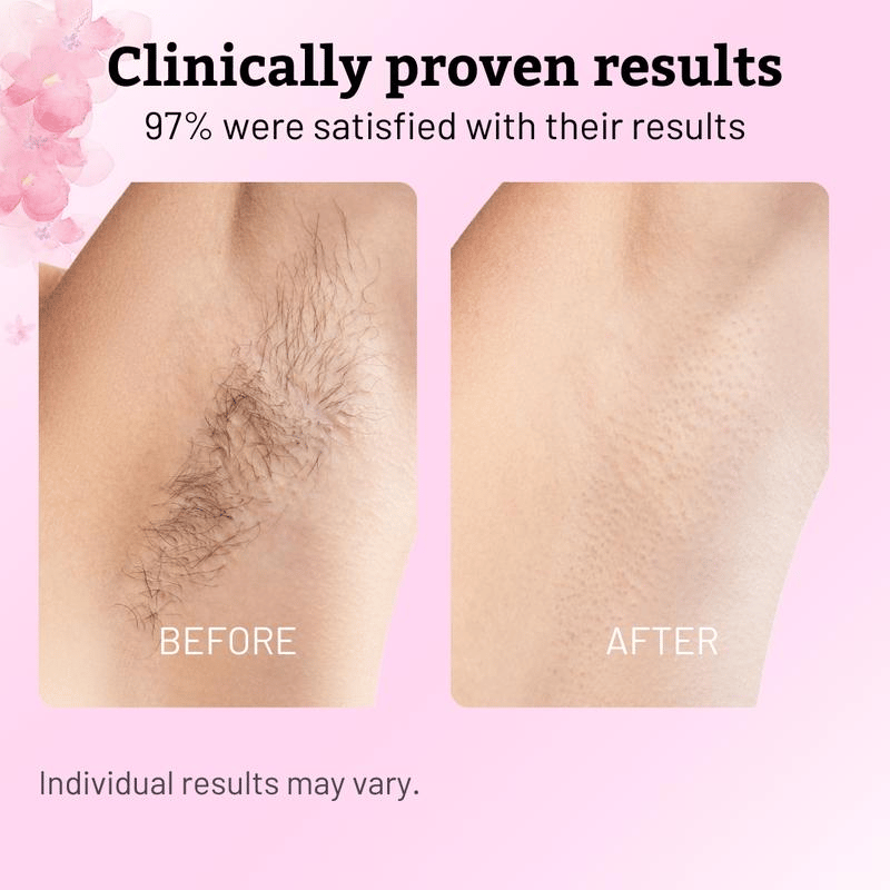 ✨ SEAGRIL Beauty Cyperus Rotundus Oil for Natural Permanent Hair Reduction