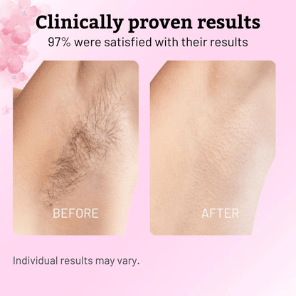 ✨ SEAGRIL Beauty Cyperus Rotundus Oil for Natural Permanent Hair Reduction