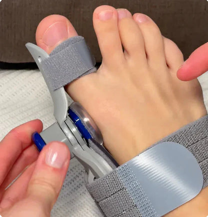 Toe area auxiliary corrector - Non-Surgical Relief for Bunion Pain